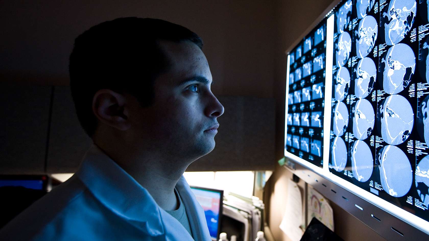 Neurologist analyzing brain scans