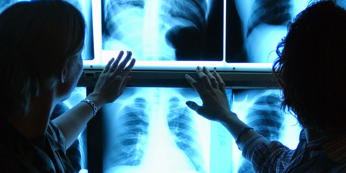 Air Force doctors examining an x-ray